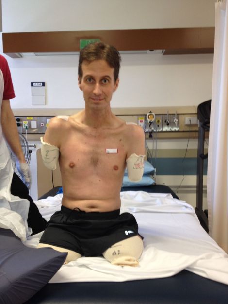 Matthew pushed hard to come off the feeding tubes and ventilator. He had to learn to eat again after damage to his tongue, and 'lost a bit of condition' in the process. It meant, however, that he could talk, which was important. 