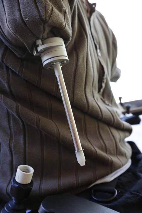 Integrum Training Arm Prosthetic Version 1.